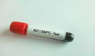 SGPT Test: Purpose, Procedure, and Importance