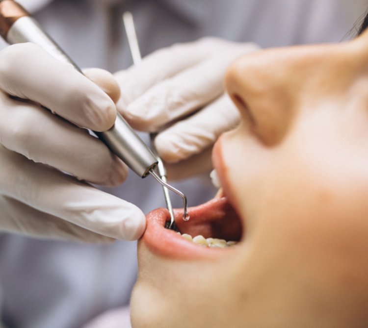 Browse Affordable Teeth Whitening & Full Mouth Implants in Borivali West