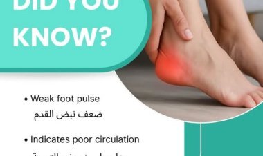 Sclerotherapy Treatment Near Me for Varicose Veins