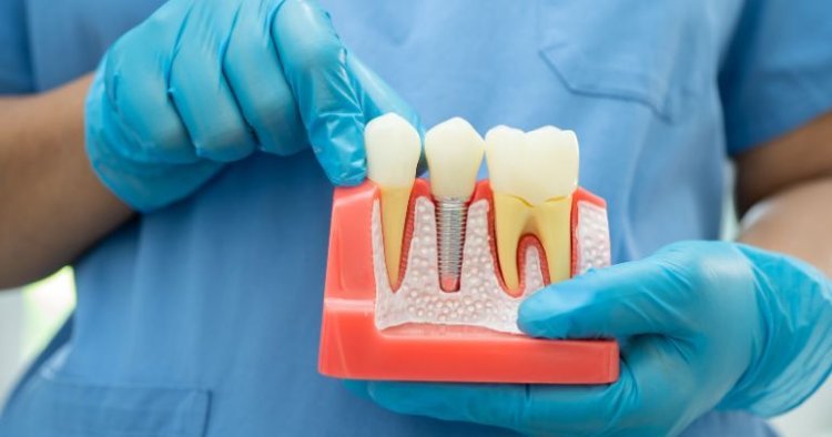 When Is a Root Canal Better Than Tooth Extraction?
